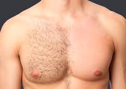 Chest Wax